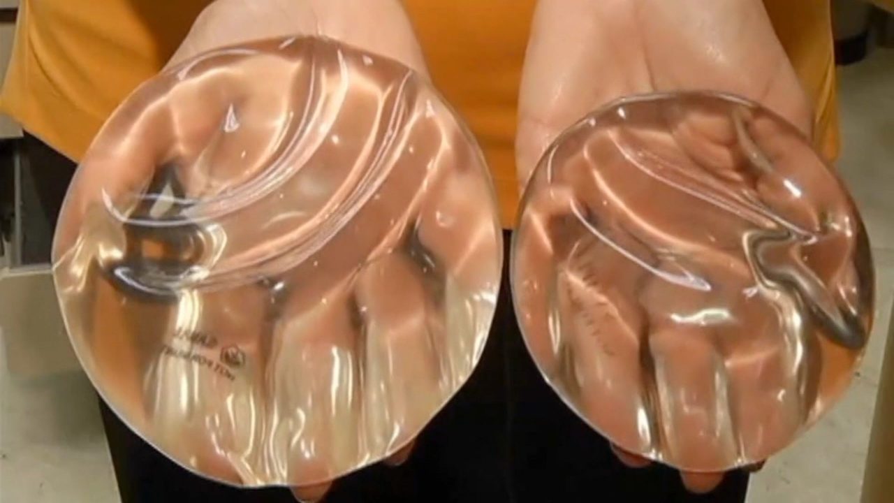 Breast implants rheumatoid arthritis properties leaves Suggest you breast implants rheumatoid arthritis what